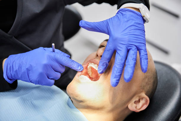 Best Chipped Tooth Repair Near Me  in Canastota, NY